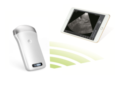 Wireless USG -ultraäänilaite